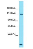 SPATA31A1 Antibody - SPATA31A2 antibody Western Blot of ACHN. Antibody dilution: 1 ug/ml.  This image was taken for the unconjugated form of this product. Other forms have not been tested.