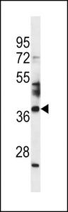 SPATA4 Antibody - SPATA4 Antibody western blot of NCI-H292 cell line lysates (35 ug/lane). The SPATA4 antibody detected the SPATA4 protein (arrow).