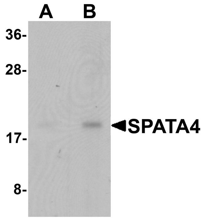 SPATA4 Antibody - Western blot analysis of SPATA4 in mouse stomach tissue lysate with SPATA4 antibody at (A) 1 and (B) 2 ug/ml.