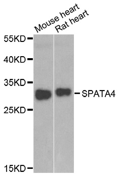 SPATA4 Antibody - Western blot analysis of extracts of various cell lines.