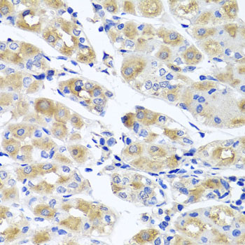 SPATA4 Antibody - Immunohistochemistry of paraffin-embedded human stomach tissue.