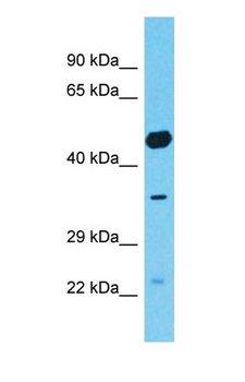 SPATA5L1 Antibody - Western blot of SPATA5L1 Antibody with human 786-0 Whole Cell lysate.  This image was taken for the unconjugated form of this product. Other forms have not been tested.