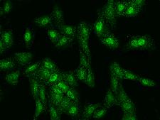 SPATA5L1 Antibody - Immunofluorescence staining of SPATA5L1 in U2OS cells. Cells were fixed with 4% PFA, permeabilzed with 0.1% Triton X-100 in PBS, blocked with 10% serum, and incubated with rabbit anti-Human SPATA5L1 polyclonal antibody (dilution ratio 1:100) at 4°C overnight. Then cells were stained with the Alexa Fluor 488-conjugated Goat Anti-rabbit IgG secondary antibody (green). Positive staining was localized to Nucleus and Cytoplasm.
