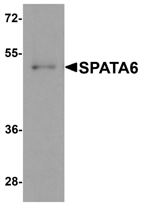 SPATA6 / SRF-1 Antibody - Western blot analysis of SPATA6 in A20 cell lysate with SPATA6 antibody at 1 ug/ml.