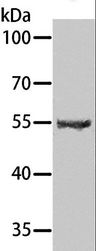 SPATA6 / SRF-1 Antibody - Western blot analysis of Human testis tissue, using SPATA6 Polyclonal Antibody at dilution of 1:1000.