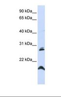 SPATA9 Antibody - HepG2 cell lysate. Antibody concentration: 1.0 ug/ml. Gel concentration: 12%.  This image was taken for the unconjugated form of this product. Other forms have not been tested.