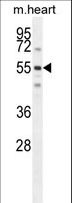 SPATC1 Antibody - SPATC1 Antibody western blot of mouse heart tissue lysates (35 ug/lane). The SPATC1 antibody detected the SPATC1 protein (arrow).