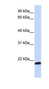 SPATC1L / C21orf56 Antibody - C21orf56 antibody Western blot of MCF7 cell lysate. This image was taken for the unconjugated form of this product. Other forms have not been tested.
