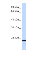 SPATC1L / C21orf56 Antibody - C21orf56 antibody Western blot of MCF7 cell lysate. This image was taken for the unconjugated form of this product. Other forms have not been tested.