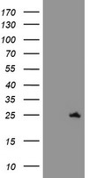 SPATC1L / C21orf56 Antibody - HEK293T cells were transfected with the pCMV6-ENTRY control (Left lane) or pCMV6-ENTRY C21orf56 (Right lane) cDNA for 48 hrs and lysed. Equivalent amounts of cell lysates (5 ug per lane) were separated by SDS-PAGE and immunoblotted with anti-C21orf56.