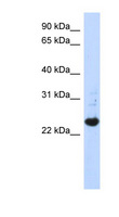 SPATC1L / C21orf56 Antibody - C21orf56 antibody Western blot of Transfected 293T cell lysate. This image was taken for the unconjugated form of this product. Other forms have not been tested.