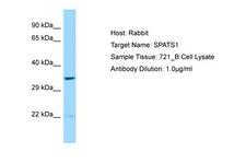 SPATS1 Antibody -  This image was taken for the unconjugated form of this product. Other forms have not been tested.