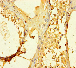 SPATS1 Antibody - Immunohistochemistry of paraffin-embedded human testis tissue using SPATS1 Antibody at dilution of 1:100