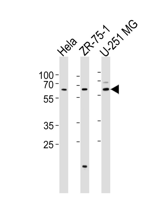 SPATS2 Antibody - Western blot of lysates from HeLa, ZR-75-1, U-251 MG cell line (from left to right) with SPATS2 Antibody. Antibody was diluted at 1:1000 at each lane. A goat anti-rabbit IgG H&L (HRP) at 1:5000 dilution was used as the secondary antibody. Lysates at 35 ug per lane.