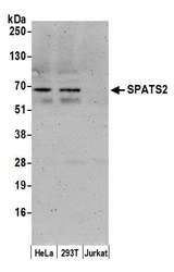 SPATS2 Antibody - Detection of human SPATS2 by western blot. Samples: Whole cell lysate (10 µg) from HeLa, HEK293T, and Jurkat cells prepared using NETN lysis buffer. Antibody: Affinity purified rabbit anti-SPATS2 antibody used for WB at 0.1 µg/ml. Detection: Chemiluminescence with an exposure time of 3 minutes.