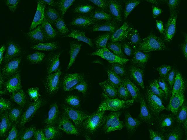 SPATS2 Antibody - Immunofluorescence staining of SPATS2 in U2OS cells. Cells were fixed with 4% PFA, permeabilzed with 0.1% Triton X-100 in PBS, blocked with 10% serum, and incubated with rabbit anti-Human SPATS2 polyclonal antibody (dilution ratio 1:200) at 4°C overnight. Then cells were stained with the Alexa Fluor 488-conjugated Goat Anti-rabbit IgG secondary antibody (green) and counterstained with DAPI (blue). Positive staining was localized to Cytoplasm.