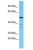SPATS2L Antibody - SPATS2L antibody Western Blot of NCI-H226. Antibody dilution: 1 ug/ml.  This image was taken for the unconjugated form of this product. Other forms have not been tested.