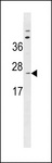 SPC18 / SEC11A Antibody - SC11A Antibody western blot of MDA-MB231 cell line lysates (35 ug/lane). The SC11A antibody detected the SC11A protein (arrow).