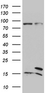 SPC18 / SEC11A Antibody - HEK293T cells were transfected with the pCMV6-ENTRY control. (Left lane) or pCMV6-ENTRY SEC11A. (Right lane) cDNA for 48 hrs and lysed. Equivalent amounts of cell lysates. (5 ug per lane) were separated by SDS-PAGE and immunoblotted with anti-SEC11A. (1:500)