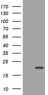 SPC18 / SEC11A Antibody - HEK293T cells were transfected with the pCMV6-ENTRY control. (Left lane) or pCMV6-ENTRY SEC11A. (Right lane) cDNA for 48 hrs and lysed. Equivalent amounts of cell lysates. (5 ug per lane) were separated by SDS-PAGE and immunoblotted with anti-SEC11A. (1:2000)