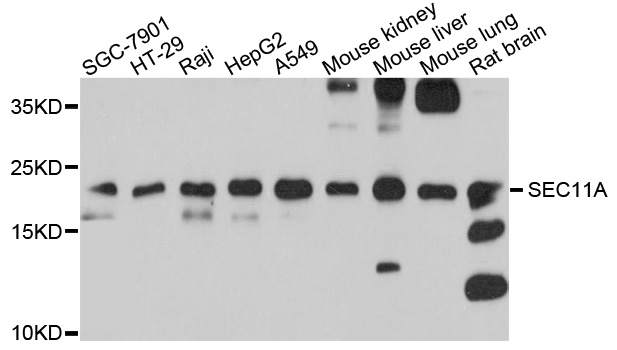 SPC18 / SEC11A Antibody - Western blot analysis of extracts of various cell lines, using SEC11A antibody at 1:1000 dilution. The secondary antibody used was an HRP Goat Anti-Rabbit IgG (H+L) at 1:10000 dilution. Lysates were loaded 25ug per lane and 3% nonfat dry milk in TBST was used for blocking. An ECL Kit was used for detection and the exposure time was 90s.