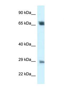 SPC25 Antibody - SPC25 antibody Western blot of 721_B Cell lysate. Antibody concentration 1 ug/ml.  This image was taken for the unconjugated form of this product. Other forms have not been tested.