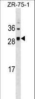 SPC25 Antibody - SPC25 Antibody western blot of ZR-75-1 cell line lysates (35 ug/lane). The SPC25 antibody detected the SPC25 protein (arrow).