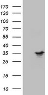 SPC25 Antibody - HEK293T cells were transfected with the pCMV6-ENTRY control (Left lane) or pCMV6-ENTRY SPC25 (Right lane) cDNA for 48 hrs and lysed. Equivalent amounts of cell lysates (5 ug per lane) were separated by SDS-PAGE and immunoblotted with anti-SPC25.