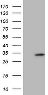 SPC25 Antibody - HEK293T cells were transfected with the pCMV6-ENTRY control (Left lane) or pCMV6-ENTRY SPC25 (Right lane) cDNA for 48 hrs and lysed. Equivalent amounts of cell lysates (5 ug per lane) were separated by SDS-PAGE and immunoblotted with anti-SPC25.