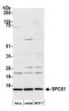 SPCS1 Antibody - Detection of human SPCS1 by western blot. Samples: Whole cell lysate (15 µg) from HeLa, Jurkat, and MCF-7 cells prepared using NETN lysis buffer. Antibody: Affinity purified rabbit anti-SPCS1 antibody used for WB at 1:1000. Detection: Chemiluminescence with an exposure time of 10 seconds.