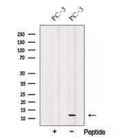 SPCS1 Antibody - Western blot analysis of extracts of PC-3 cells using SPCS1 antibody. The lane on the left was treated with blocking peptide.