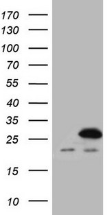 SPCS2 Antibody - HEK293T cells were transfected with the pCMV6-ENTRY control. (Left lane) or pCMV6-ENTRY SPCS2. (Right lane) cDNA for 48 hrs and lysed. Equivalent amounts of cell lysates. (5 ug per lane) were separated by SDS-PAGE and immunoblotted with anti-SPCS2. (1:2000)