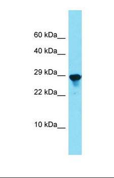 SPCS2 Antibody - Western blot of Rat Lung. Spcs2 antibody dilution 1.0 ug/ml.  This image was taken for the unconjugated form of this product. Other forms have not been tested.