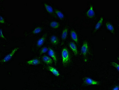 SPCS2 Antibody - Immunofluorescent analysis of Hela cells using SPCS2 Antibody at dilution of 1:100 and Alexa Fluor 488-congugated AffiniPure Goat Anti-Rabbit IgG(H+L)