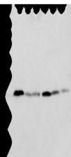SPCS2 Antibody - Western blot analysis of K-562 cell Human placenta tissue Mouse adrenal gland tissue HT-29 cell NIH/3T3 cell Rat lung tissue  using SPCS2 Polyclonal Antibody at dilution of 1:500