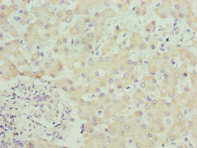 SPCS3 Antibody - Immunohistochemistry of paraffin-embedded human liver tissue using SPCS3 Antibody at dilution of 1:100
