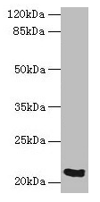 SPCS3 Antibody - Western blot All lanes: SPCS3 antibody at 0.1µg/ml + Mouse kidney tissue Secondary Goat polyclonal to rabbit at 1/10000 dilution Predicted band size: 20 kDa Observed band size: 20 kDa