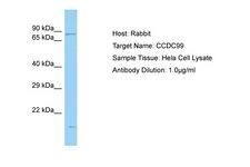 SPDL1 / CCDC99 Antibody -  This image was taken for the unconjugated form of this product. Other forms have not been tested.