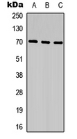 SPDL1 / CCDC99 Antibody - Western blot analysis of CCDC99 expression in HeLa (A); NIH3T3 (B); mouse kidney (C) whole cell lysates.