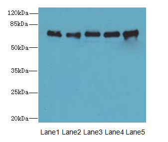 SPDL1 / CCDC99 Antibody - Western blot. All lanes: SPDL1 antibody at 4 ug/ml. Lane 1: HeLa whole cell lysate. Lane 2: 293T whole cell lysate. Lane 3: Jurkat whole cell lysate. Lane 4: A549 whole cell lysate. Lane 5: K562 whole cell lysate. Secondary Goat polyclonal to Rabbit IgG at 1:10000 dilution. Predicted band size: 70 kDa. Observed band size: 70 kDa.
