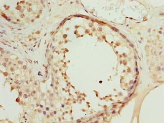 SPDL1 / CCDC99 Antibody - Immunohistochemistry of paraffin-embedded human testis tissue using SPDL1 Antibody at dilution of 1:100