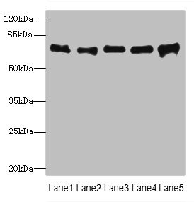 SPDL1 / CCDC99 Antibody - Western blot All lanes: SPDL1 antibody at 4µg/ml Lane 1: Hela whole cell lysate Lane 2: 293T whole cell lysate Lane 3: Jurkat whole cell lysate Lane 4: A549 whole cell lysate Lane 5: K562 whole cell lysate Secondary Goat polyclonal to rabbit IgG at 1/10000 dilution Predicted band size: 71, 59, 62 kDa Observed band size: 71 kDa