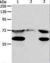 SPDL1 / CCDC99 Antibody - Western blot analysis of HeLa cell, mouse testis tissue and Jurkat cell, using SPDL1 Polyclonal Antibody at dilution of 1:400.