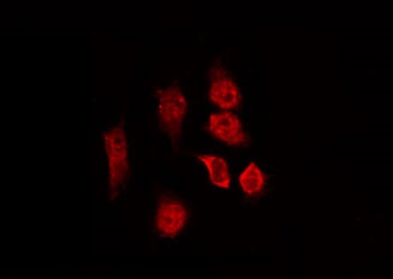 SPDL1 / CCDC99 Antibody - Staining NIH-3T3 cells by IF/ICC. The samples were fixed with PFA and permeabilized in 0.1% Triton X-100, then blocked in 10% serum for 45 min at 25°C. The primary antibody was diluted at 1:200 and incubated with the sample for 1 hour at 37°C. An Alexa Fluor 594 conjugated goat anti-rabbit IgG (H+L) Ab, diluted at 1/600, was used as the secondary antibody.