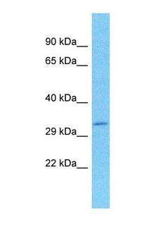 SPDYC Antibody - Western blot of Human HT1080. SPDYC antibody dilution 1.0 ug/ml.  This image was taken for the unconjugated form of this product. Other forms have not been tested.