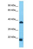 SPDYE1 Antibody - SPDYE1 antibody Western Blot of Fetal Heart. Antibody dilution: 1 ug/ml.  This image was taken for the unconjugated form of this product. Other forms have not been tested.