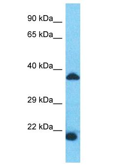 SPDYE1 Antibody - SPDYE1 antibody Western Blot of Fetal Heart. Antibody dilution: 1 ug/ml.  This image was taken for the unconjugated form of this product. Other forms have not been tested.