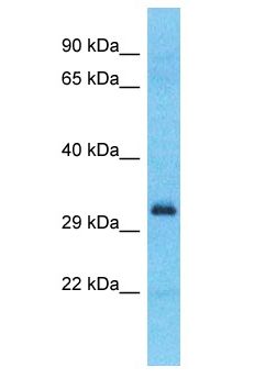 SPDYE2L Antibody - SPDYE2B / SPDYE2L antibody Western Blot of MCF7. Antibody dilution: 1 ug/ml.  This image was taken for the unconjugated form of this product. Other forms have not been tested.