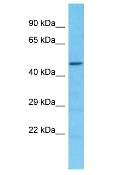 SPDYE2L Antibody - SPDYE2B / SPDYE2L antibody Western Blot of HeLa. Antibody dilution: 1 ug/ml.  This image was taken for the unconjugated form of this product. Other forms have not been tested.