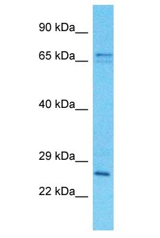 SPDYE2L Antibody - SPDYE2B / SPDYE2L antibody Western Blot of HCT15. Antibody dilution: 1 ug/ml.  This image was taken for the unconjugated form of this product. Other forms have not been tested.